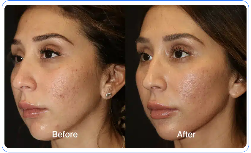 n1o1 before after 01