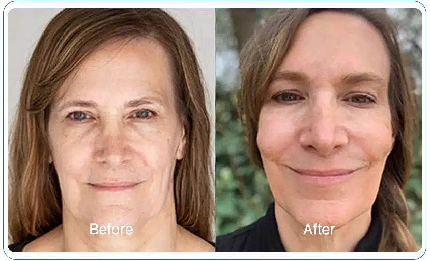 n1o1 before after 02 1