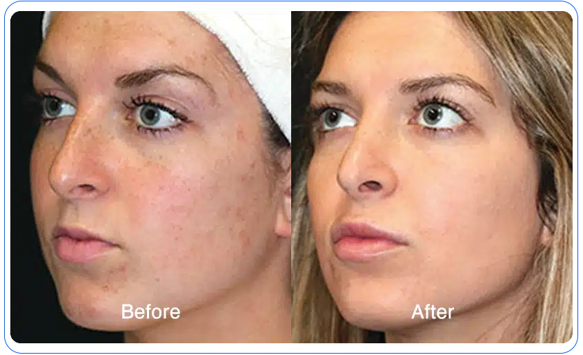 n1o1 before after 05