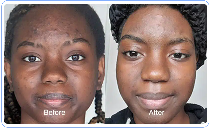 n1o1 before after 07