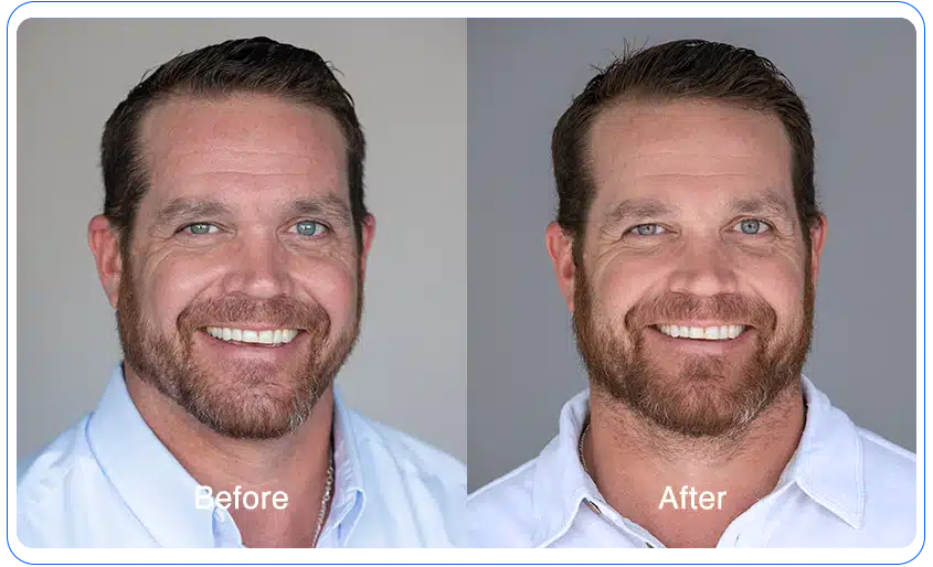 n1o1 before after 18