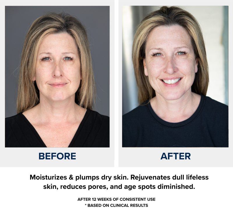 n1o1 nitric oxide - before after - rejuventates skin